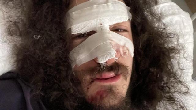 "Меня били ногами семеро полицейских" Идет ли Грузия по пути Беларуси 1 d2b962e031b713becf435f160d36755b