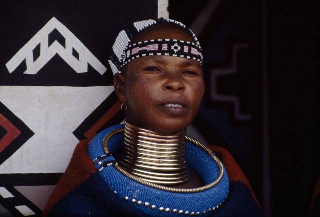 Почему толстая шея вредна для здоровья и что значит, когда она тонкая 3 277095aabf69187ff4a4db6a78afbe7c