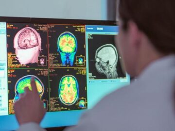 d0f3a803a2f296c8b544302c0b34b408