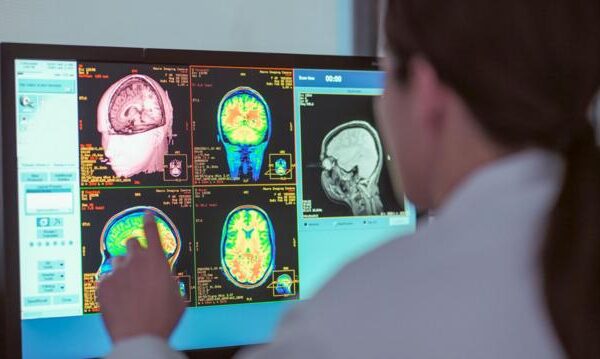 d0f3a803a2f296c8b544302c0b34b408