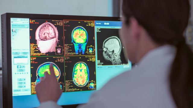 d0f3a803a2f296c8b544302c0b34b408