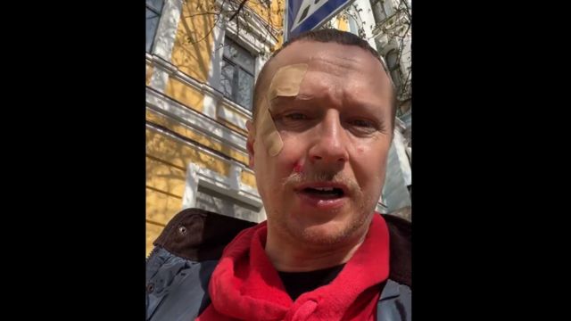 2158fb547a9b78e0f7afffaf9cbf2ea1