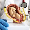 Искусственная плацента. Сможет ли она спасти преждевременно рожденных детей 3 94720abff41ceb294e991d7311ee5f0a