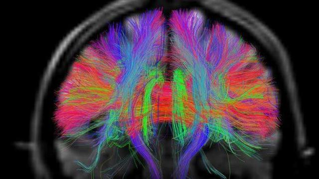 Ученые совершили прорыв в изучении мозга мухи. Он поможет понять мышление человека 2 ea74e99ddb14abc2ede66ac38bfe2ca4