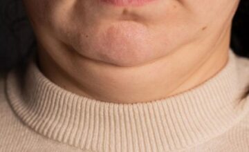 3280bed7d197814faef30f37888265df