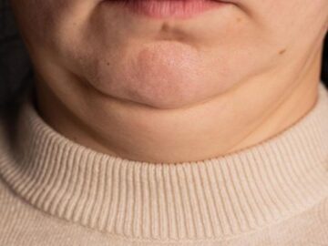 Спорт 67 3280bed7d197814faef30f37888265df