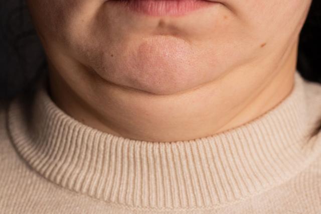 Почему толстая шея вредна для здоровья и что значит, когда она тонкая 1 3280bed7d197814faef30f37888265df